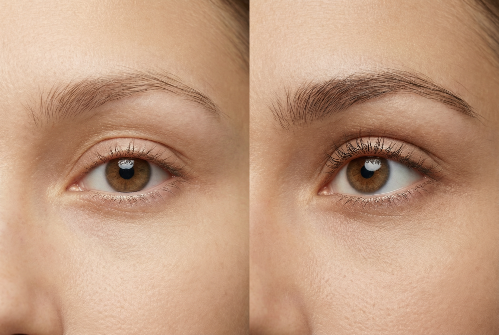 olio di ricino miracoloso capelli nanolash